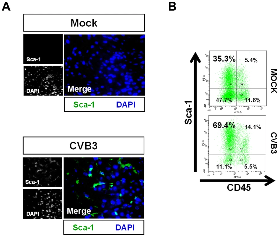 Acute CVB3 infection in juvenile mice induced an increase in myocardial Sca-1 expression.