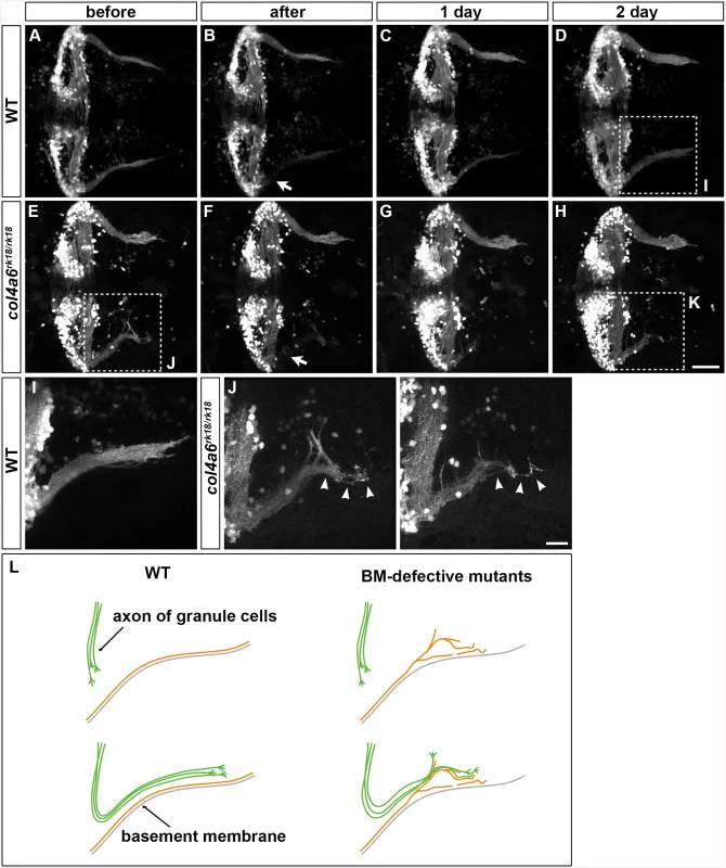 Abnormality in regenerating GC axons is linked to the abnormal BM structure in <i>col4a6</i> mutants.
