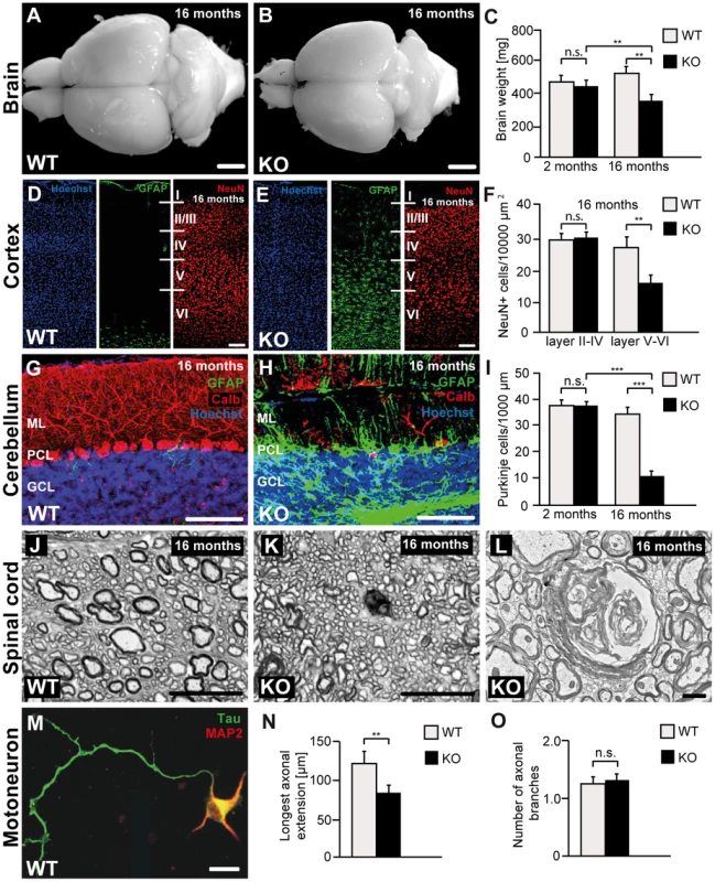 Disruption of <i>Zfyve26</i> causes severe neuron loss in the motor cortex and cerebellum.