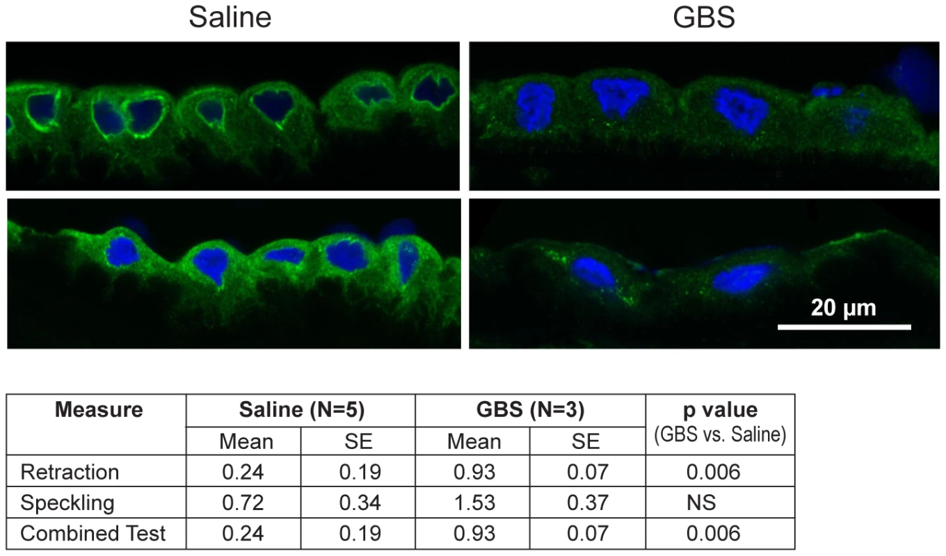 CK-6 immunostained samples of chorioamnion were imaged by confocal microscopy with representative images of saline controls and GBS cases.