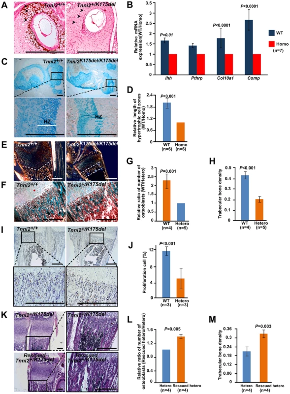 Chondrocytes differentiation and osteoblasts proliferation were impaired in mutant long bones.