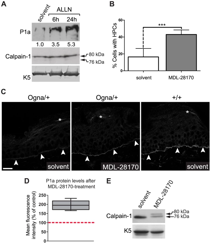 Calpain inhibitors restore P1a expression and HD formation in Ogna keratinocytes and Ogna mice.