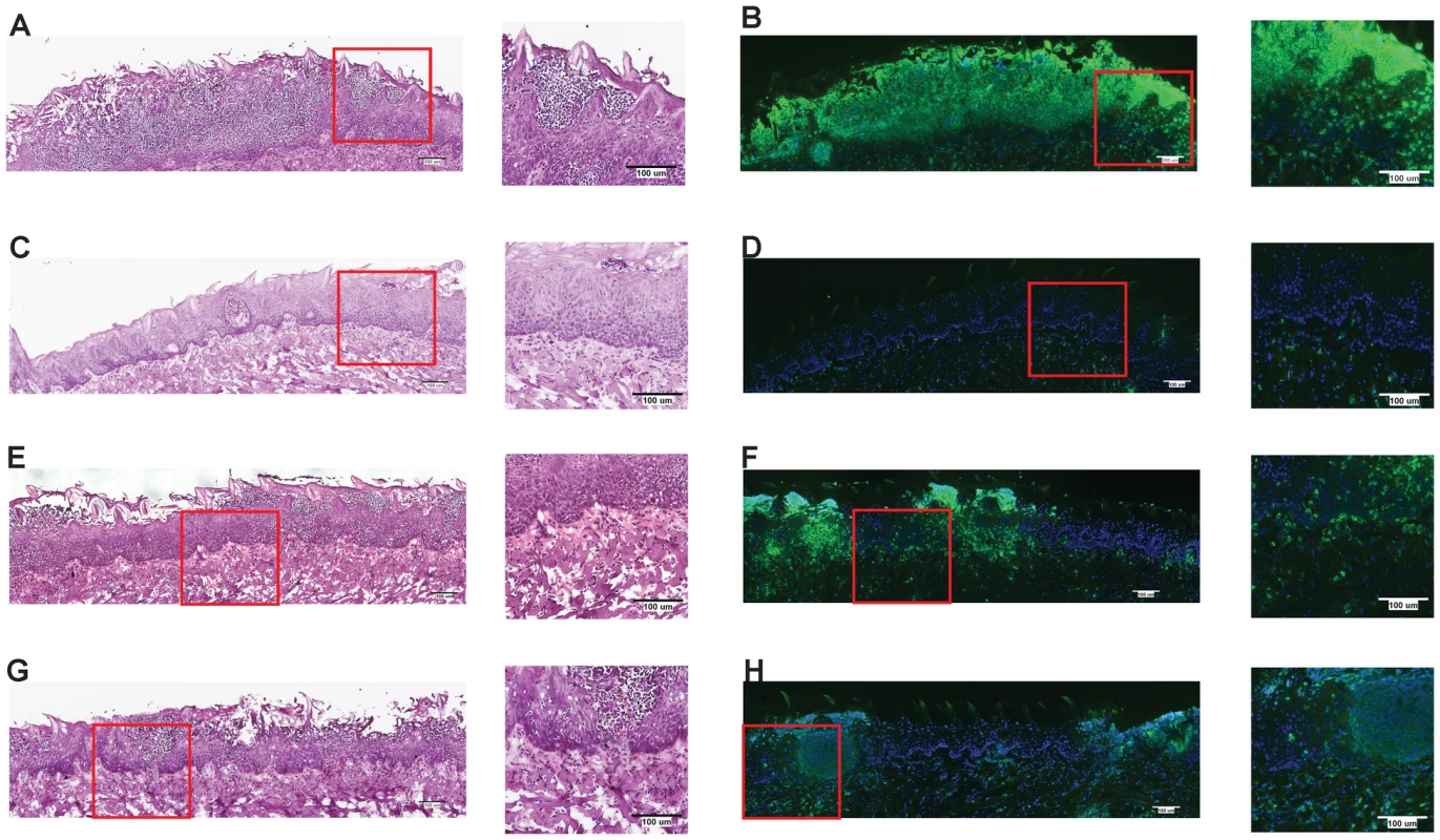 NLRC4 inflammasome mediates neutrophil influx response to mucosal <i>Candida</i> infection.