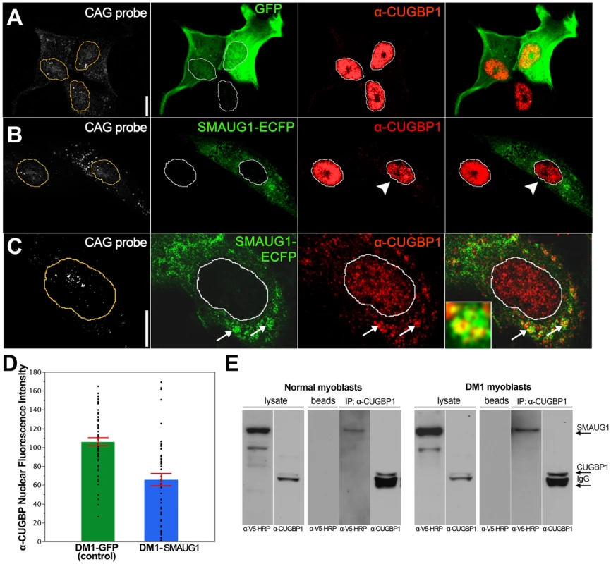 SMAUG1 and CUGBP1 co-localize and physically interact in DM1 myoblasts.