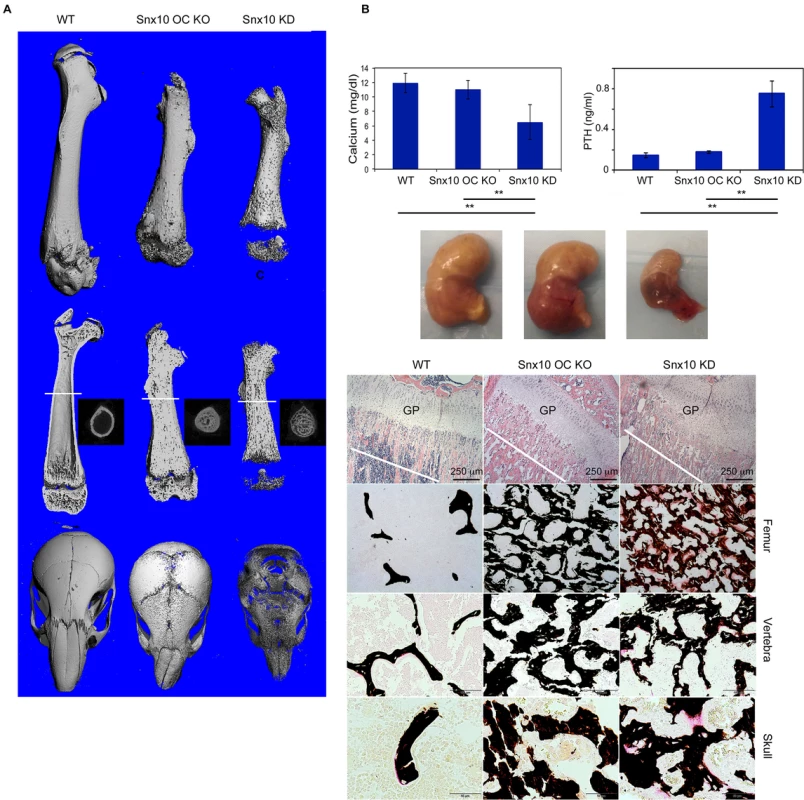 Histology and Micro CT analysis of Snx10 OC KO mice.