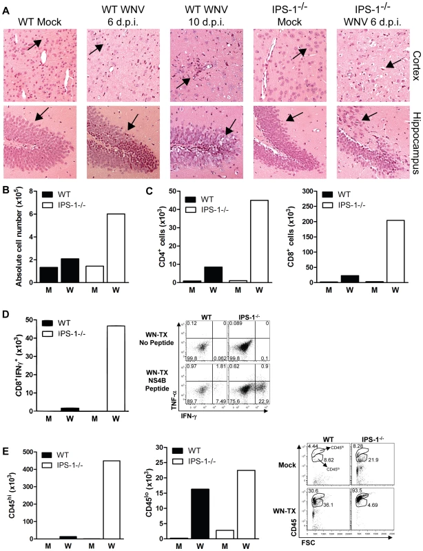 Increased CNS inflammation in WNV-infected IPS-1<sup>−/−</sup> mice.