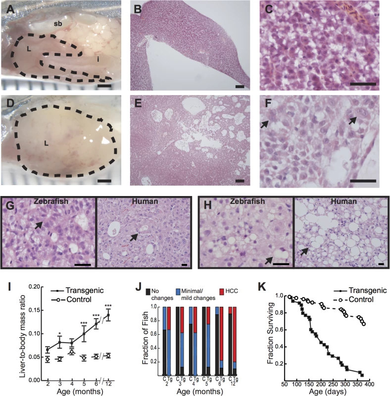 Hepatocyte-specific expression of activated β-catenin results in liver enlargement, hepatocellular carcinoma (HCC), and decreased survival in adult zebrafish.
