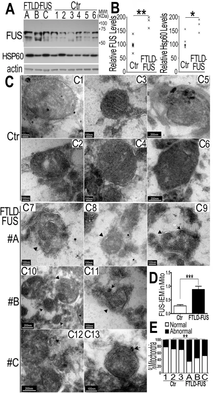 Increased FUS protein levels and mitochondrial damage detected in 3 independent FTLD-FUS brain samples.