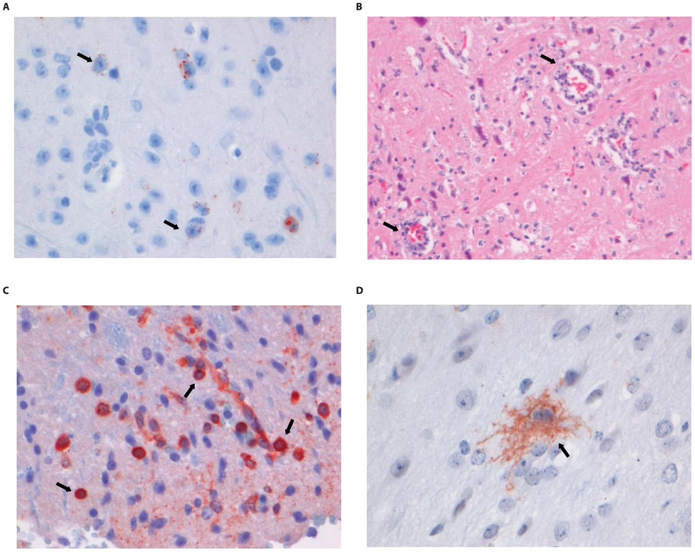Histopathology of 8-week old BALB/c mice infected i.m. with 10<sup>6</sup> TCID<sub>50</sub> of DUVV-NL07.