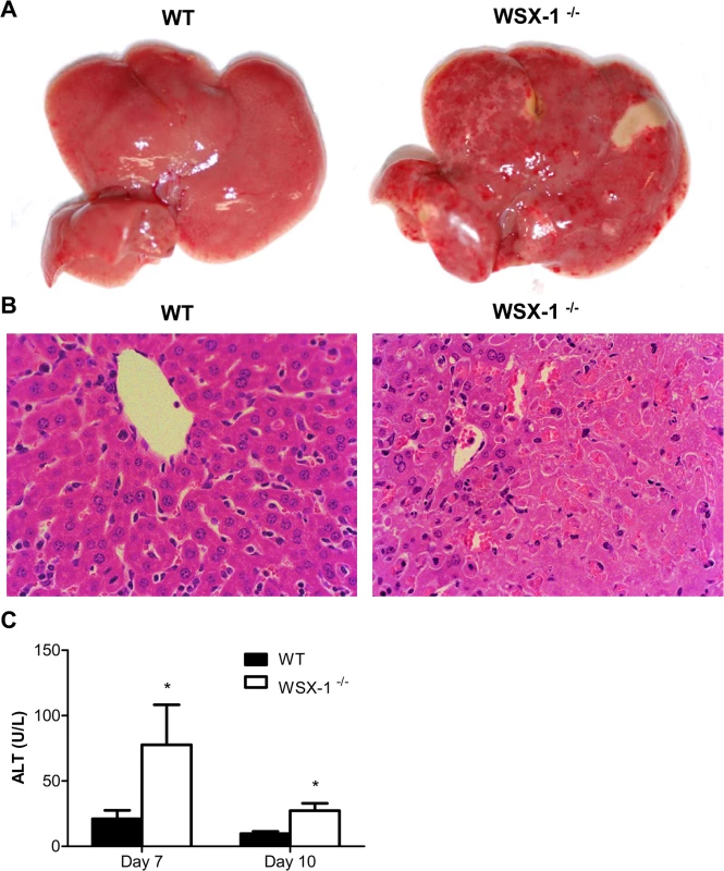 IL-27 signaling is required to prevent liver immunopathology during infection with <i>T</i>. <i>congolense</i>.