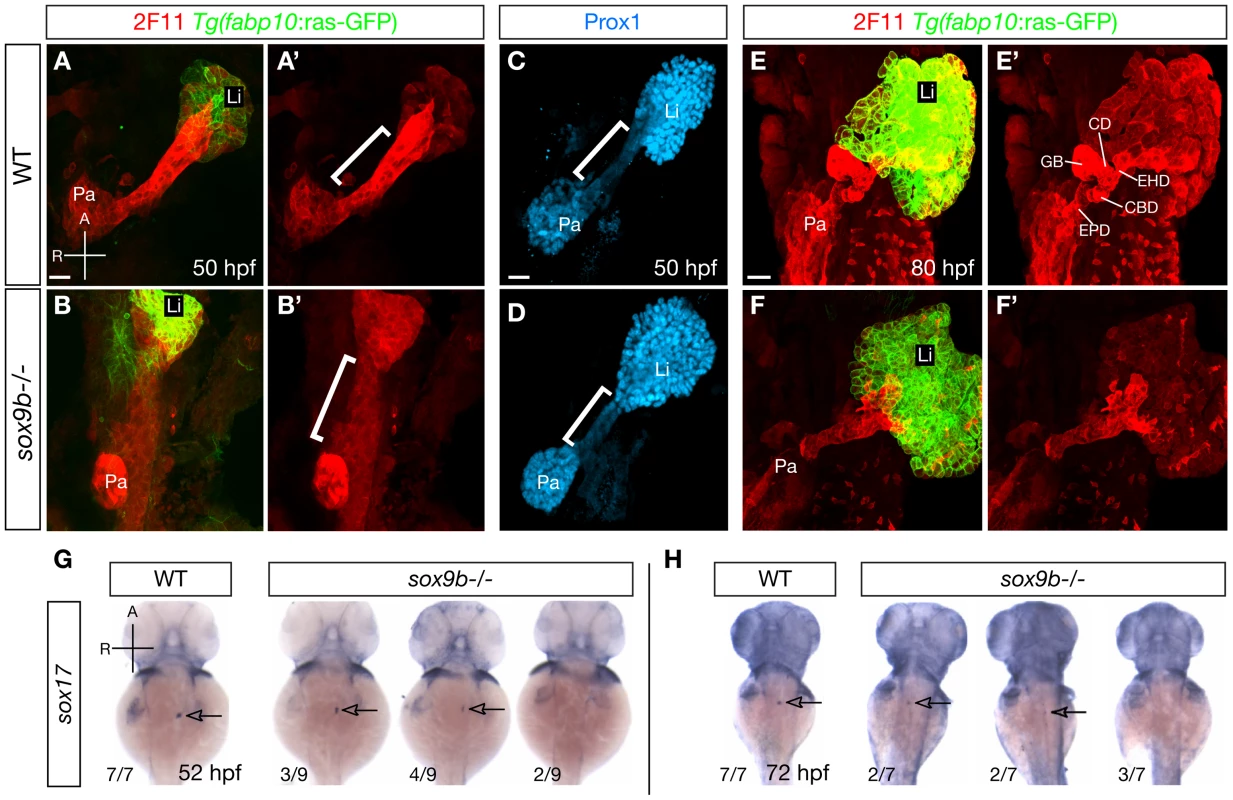 <i>sox9b</i> mutants display defective HPD patterning during organ development.
