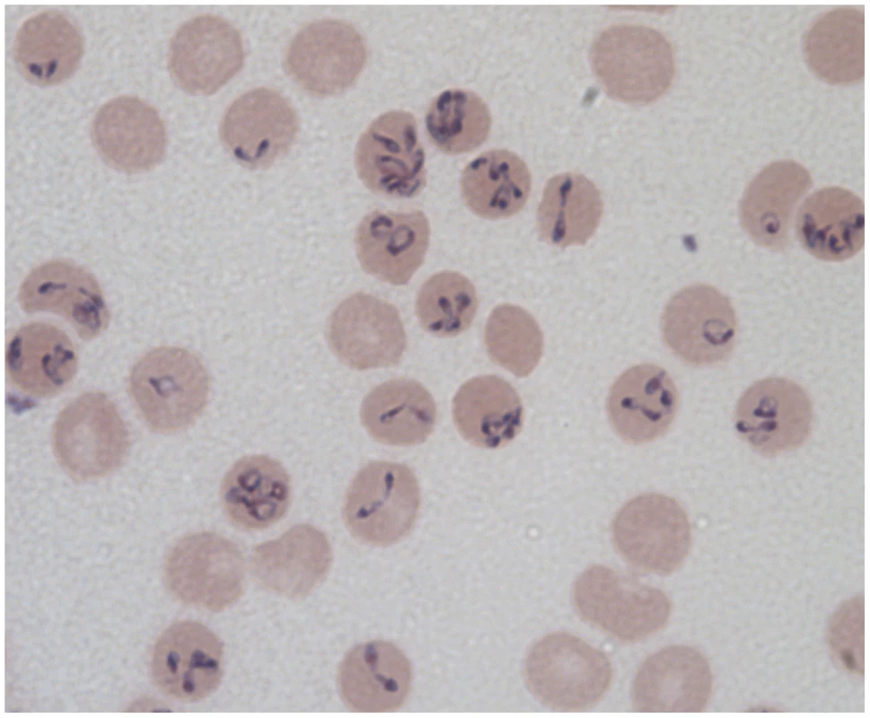 Different forms of &lt;i&gt;Babesia divergens&lt;/i&gt; in human RBCs as seen on a Giemsa-stained smear from &lt;i&gt;in vitro&lt;/i&gt; cultured parasites (ring, dividing figure eights, Maltese cross parasites, and multiply infected RBCs).