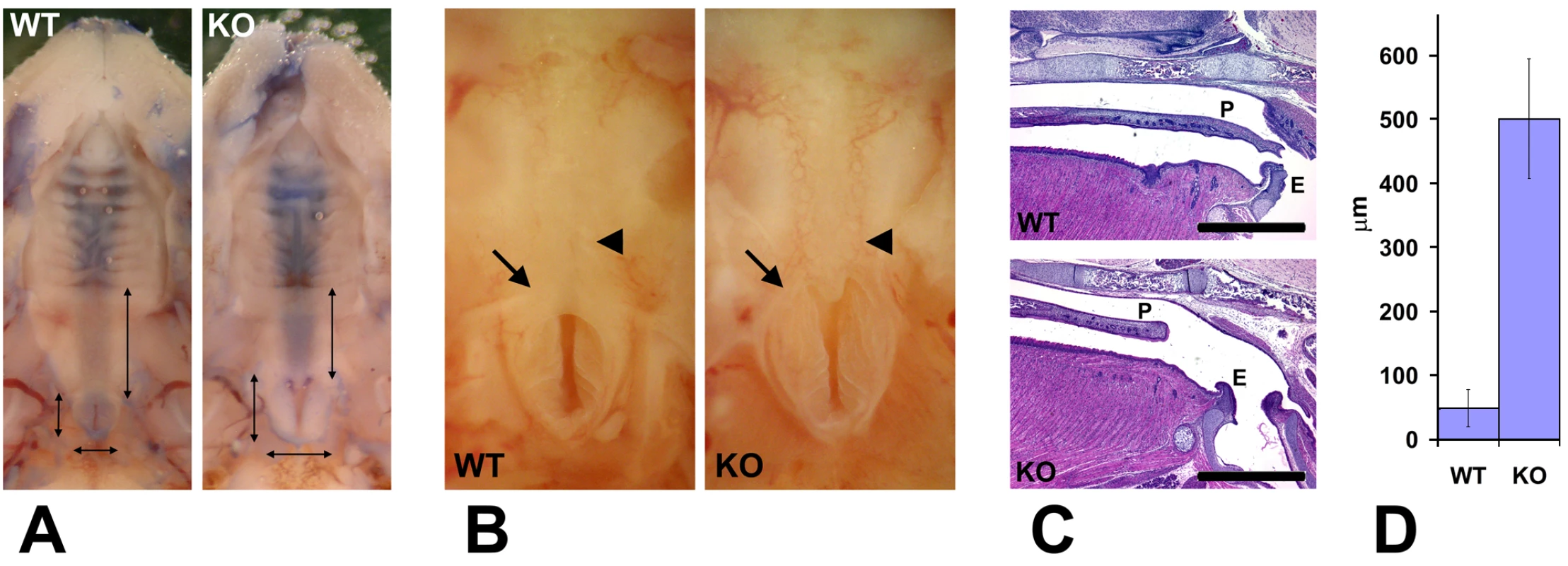 Wnt1-Ate1 mice have palate defects.