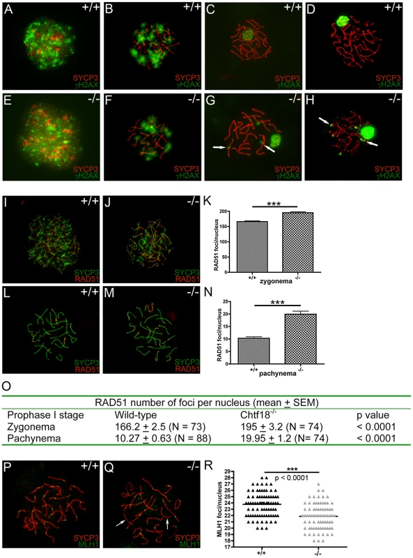 Meiotic recombination is defective in <i>Chtf18</i><sup>−/−</sup> spermatocytes.