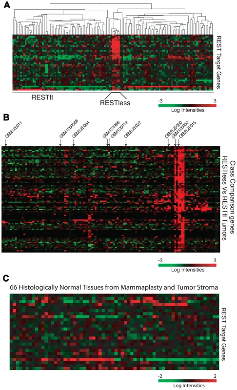The 24-gene signature detects loss of REST function in breast tumors.