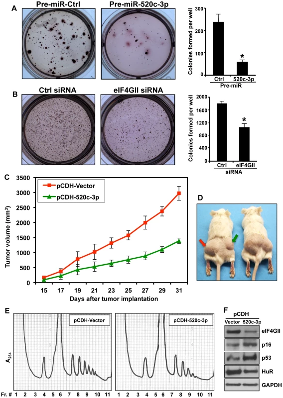 Overexpression of miR-520c-3p in DLBCL diminished colony formation in clonogenic assay and decreased tumor growth in xenograft model.