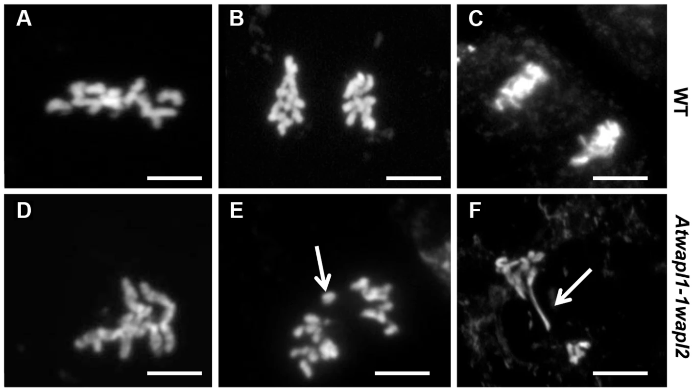 <i>Atwapl1-1wapl2</i> plants show defects in mitosis.