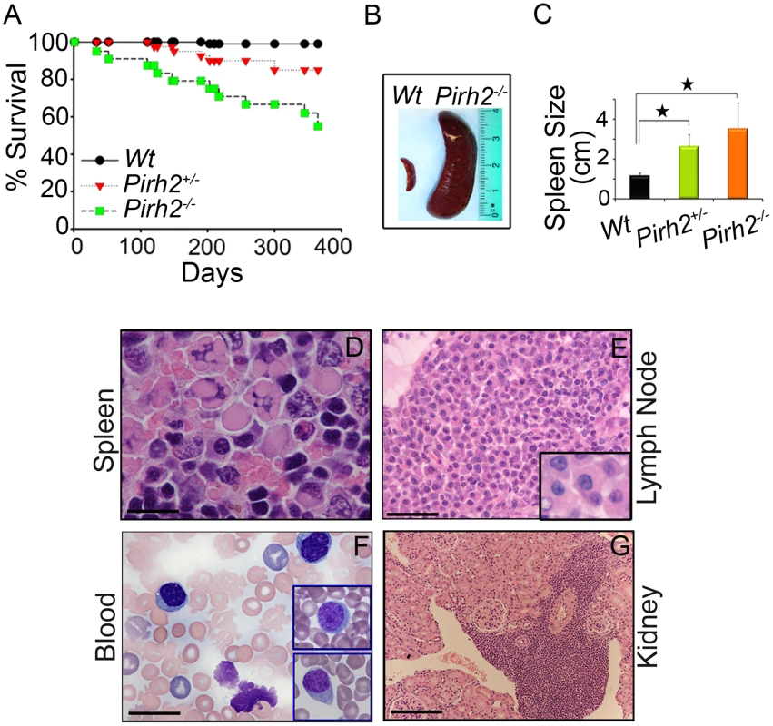 Shorter Life Span and Plasma Cell Hyperplasia of <i>Pirh2</i> Mutant Mice.