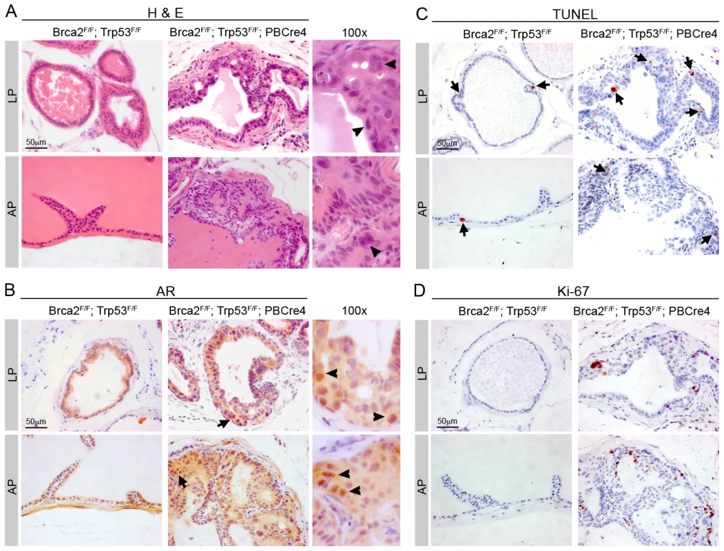 <i>Brca2;Trp53</i> PIN lesions proliferate post-castration.