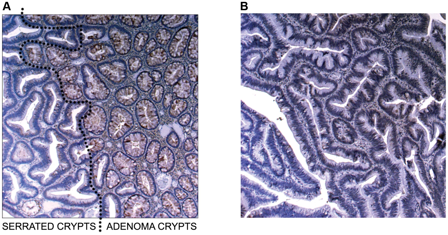 Image of IHC stains for SLIT2.