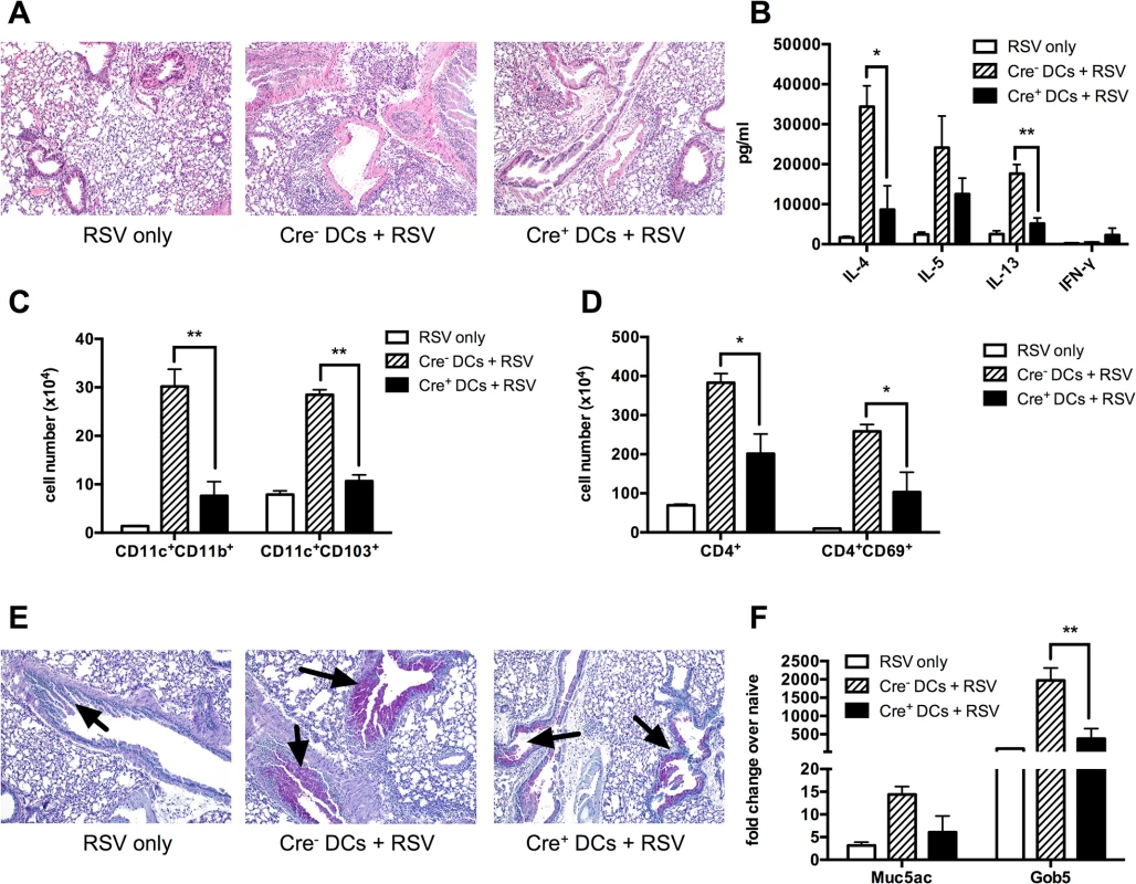 Sensitizing the lungs with <i>Kdm5b</i><sup>f/f</sup>-CD11c-Cre<sup>+</sup> DCs prior to infection results in decreased pathology following RSV challenge.