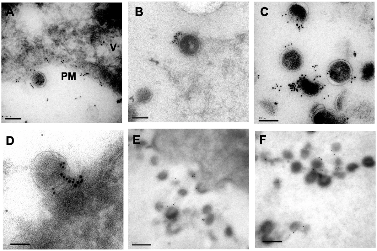 Immunoelectron micrographic analysis of cryosections from IFN-α stimulated, NL4.3/Udel-infected A3.01 cells.
