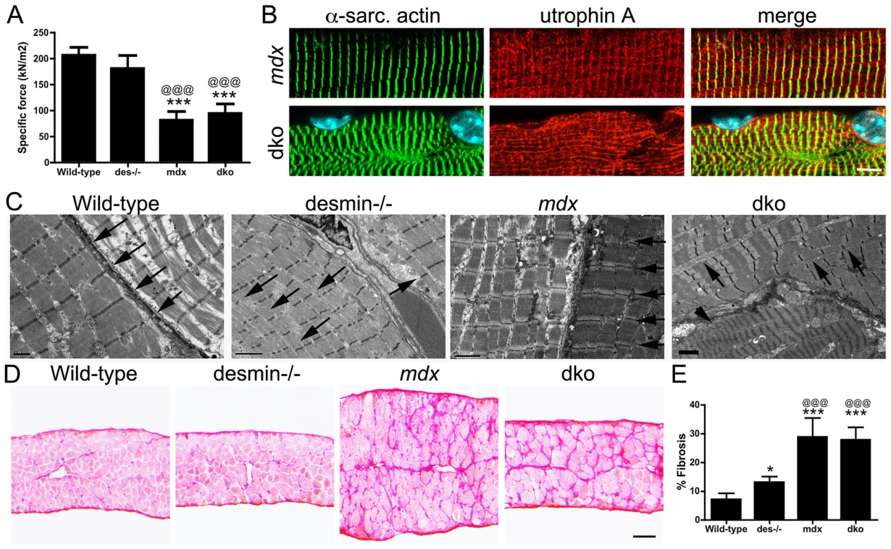Impaired diaphragm function in the dko correlates with loss of sarcomere alignment and deposition of collagen.