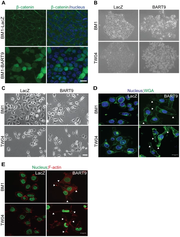 miR-BART9 induces β-catenin translocation and a mesenchymal-like morphology in EBV-negative NPC cells.