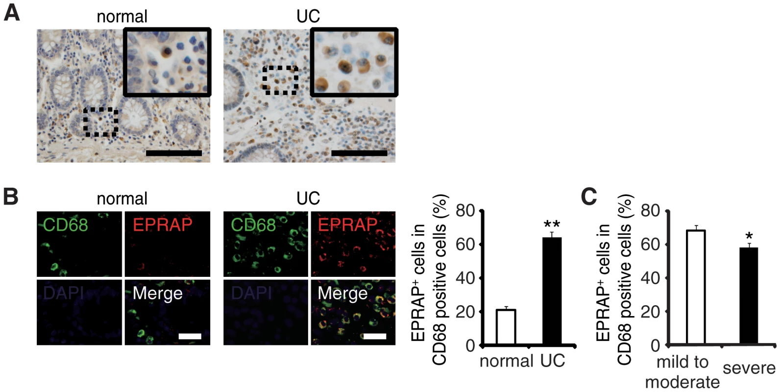 The colons of ulcerative colitis (UC) showed accumulation of EPRAP-positive macrophages.