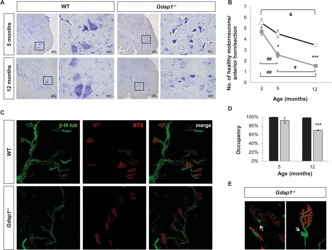 Lack of GDAP1 leads to loss of motor neurons and abnormal neuromuscular junctions.