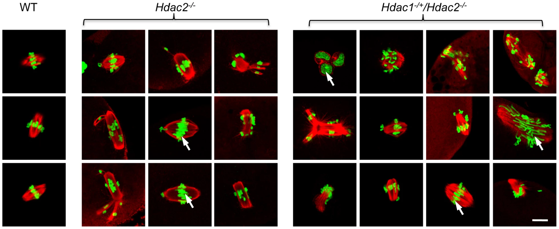 Loss of maternal HDAC2 causes defective chromosome condensation and congression in MII eggs.