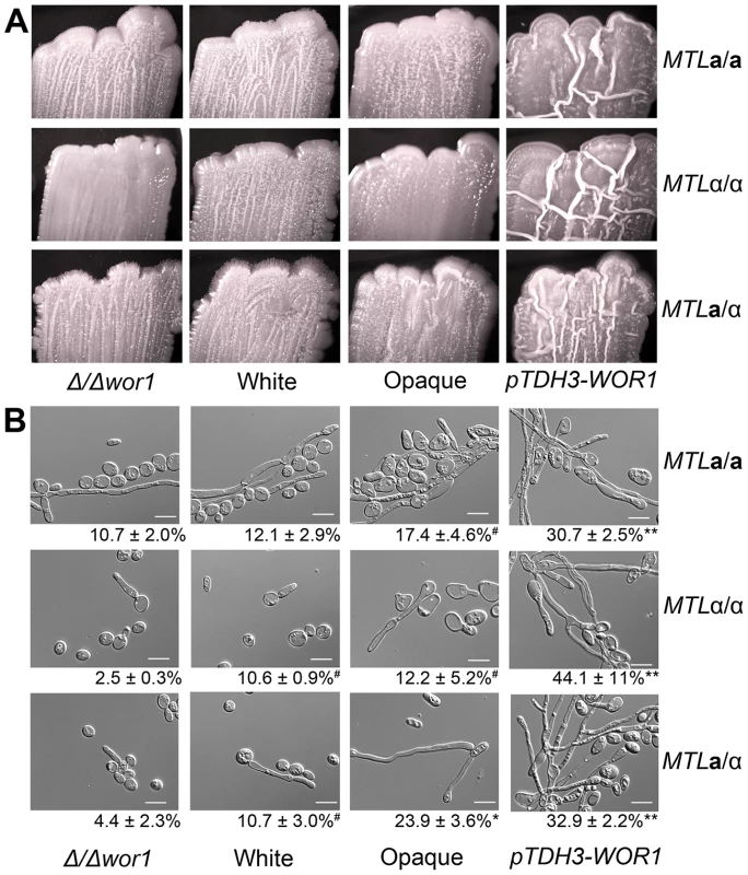 <i>C. tropicalis WOR1</i> expression regulates filamentous growth.