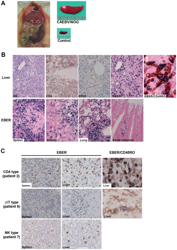 Pathological and immunochemical analyses on NOG mice transplanted with PBMC from CAEBV patients.
