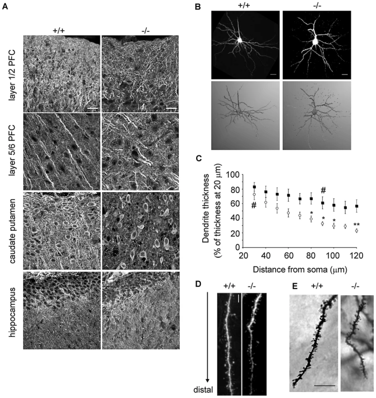 Abnormal dendritic morphology in β-III spectrin −/− mouse compared to wild type.
