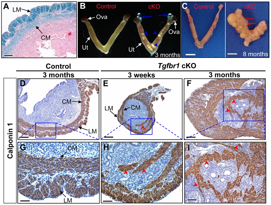 <i>Tgfbr1</i> cKO mice demonstrate disrupted uterine smooth muscle development.