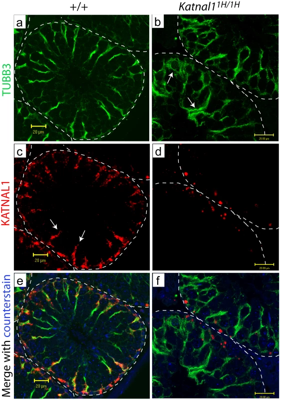 Katnal1 co-localises with Sertoli cell microtubules, but is restricted to basal regions in mutant testes.