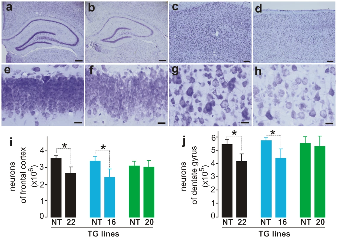 Loss of neurons in the cortex and hippocampus of mutant FUS transgenic rats.