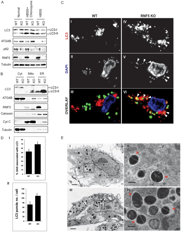 RNF5 affects engulfment of GAS in autophagosomes.