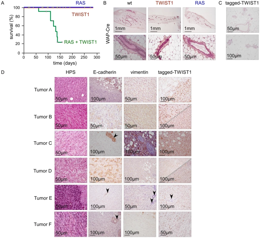 Twist1 promotes tumor initiation <i>in vivo</i>.