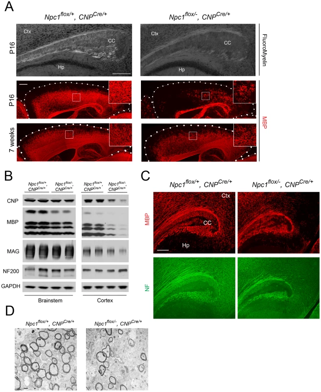 Forebrain dysmyelination in mice with oligodendrocyte-specific deletion of <i>Npc1</i>.