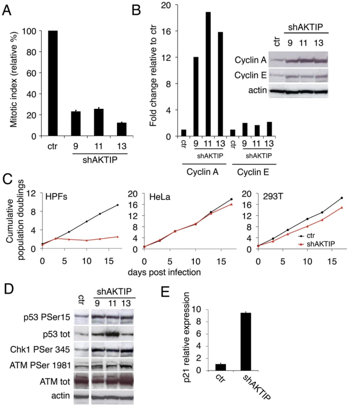 AKTIP depletion affects cell cycle progression and induces the DNA damage response (DDR).