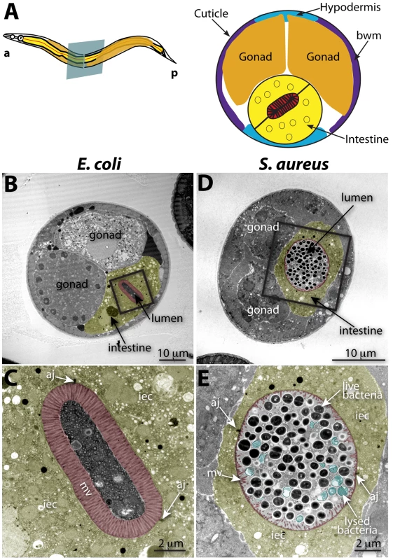 Intestinal distention, enterocyte effacement, and bacterial lysis at 12 h of <i>S. aureus</i> infection in <i>C. elegans</i>.