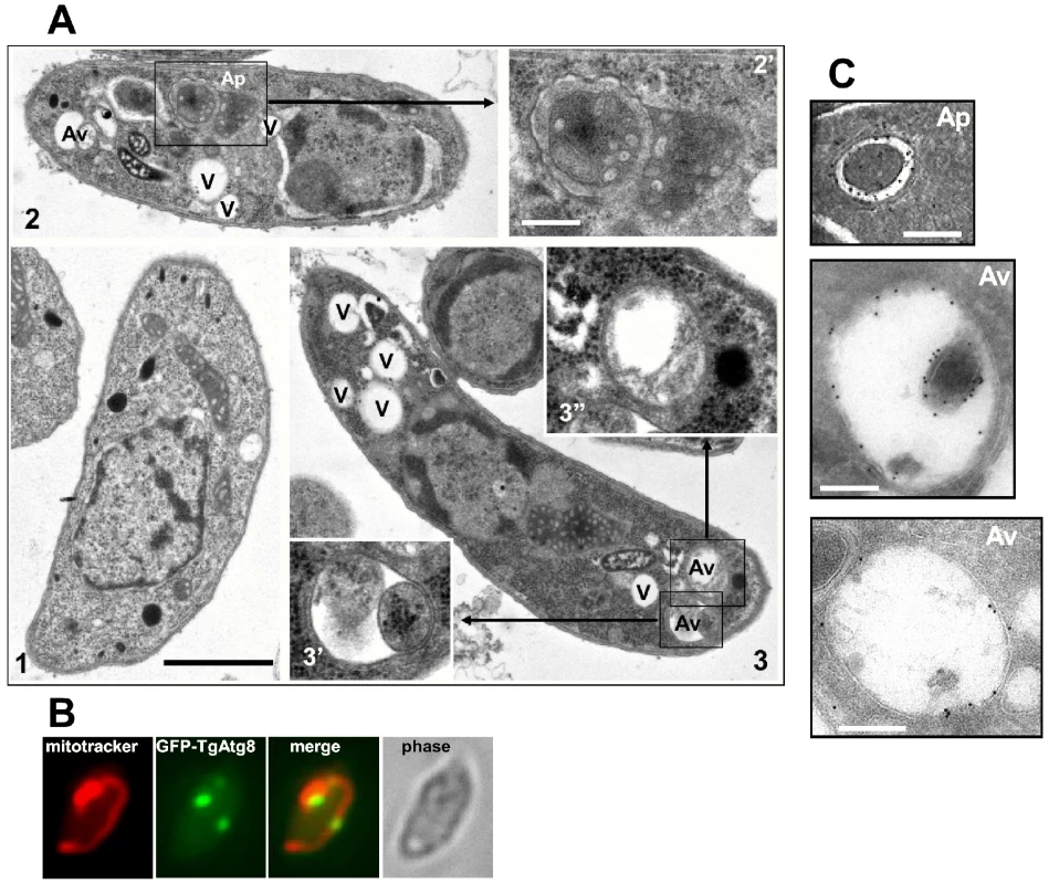 Morphological observation of autophagic vesicles in extracellular tachyzoites by electron microscopy.
