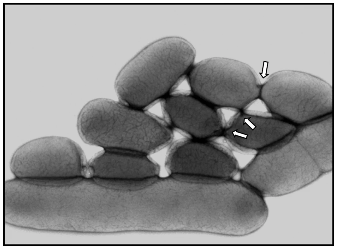 Electron microscopy of IP32637 grown at 4°C in LB with agitation.