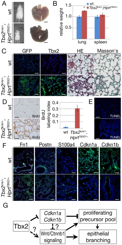 Prolonged expression of TBX2 maintains proliferation of mesenchymal progenitor cells in the adult lung.