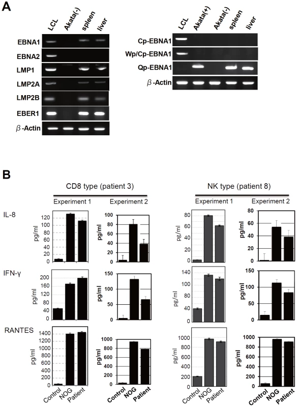 Analyses on the latent EBV gene expression and cytokine production in NOG mice transplanted with PBMC of CAEBV patients.