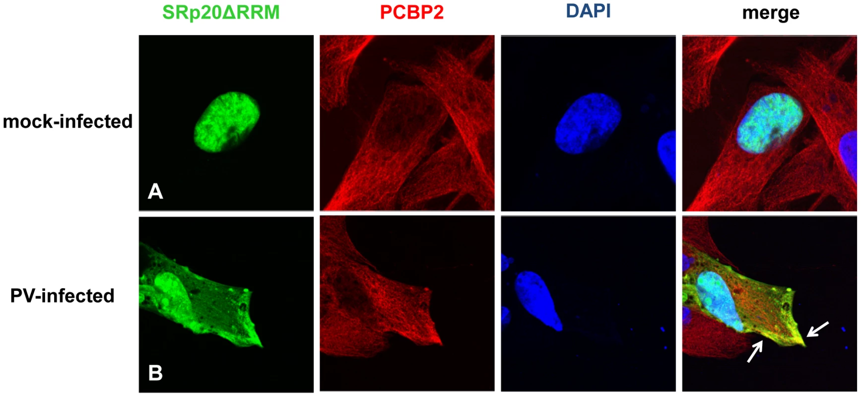 SRp20ΔRRM partial co-localization with PCBP2 in the cytoplasm of poliovirus-infected SK-N-SH cells.