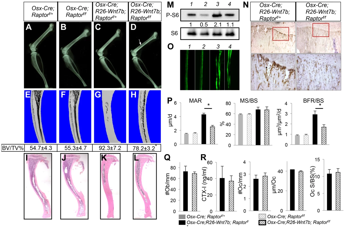 Removal of <i>Raptor</i> partially rescues WNT7B-induced bone formation.