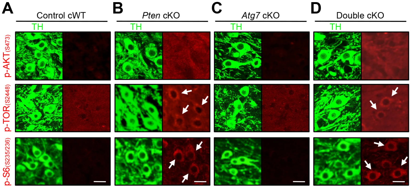 Characterization of PI3K/mTOR pathways in TH-positive DA neurons of <i>Atg7</i> and/or <i>Pten</i> cKO mice.