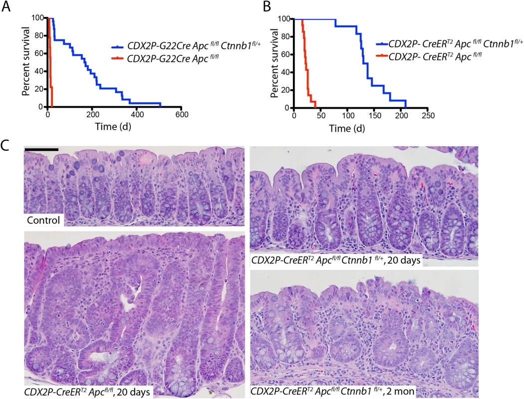 <i>Apc</i> mutation-induced polyposis in mouse cecum and colon epithelium is dramatically inhibited by concurrent inactivation of one <i>Ctnnb1</i> allele.